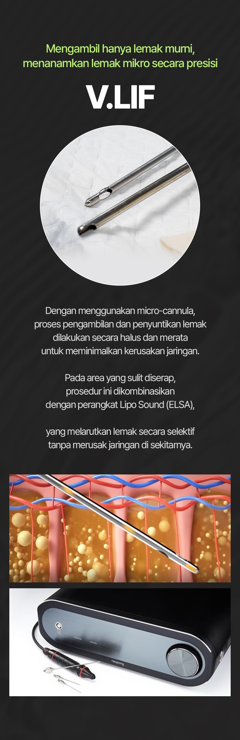 Mengambil hanya lemak murni, menanamkan lemak mikro secara presisi V.LIF Dengan menggunakan micro-cannula, proses pengambilan dan penyuntikan lemak dilakukan secara halus dan merata untuk meminimalkan kerusakan jaringan. Pada area yang sulit diserap, prosedur ini dikombinasikan dengan perangkat Lipo Sound (ELSA), yang melarutkan lemak secara selektif tanpa merusak jaringan di sekitarnya.