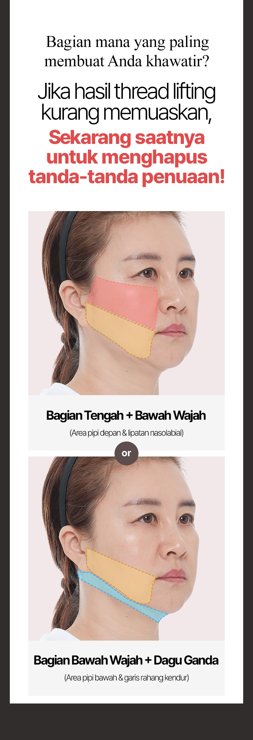 Bagian mana yang paling membuat Anda khawatir? Di V.LIF SMAS Mini Facelift, Anda bisa memilih area yang ingin diperbaiki! Bagian Bawah Wajah + Dagu Ganda (Area pipi bawah & garis rahang kendur)