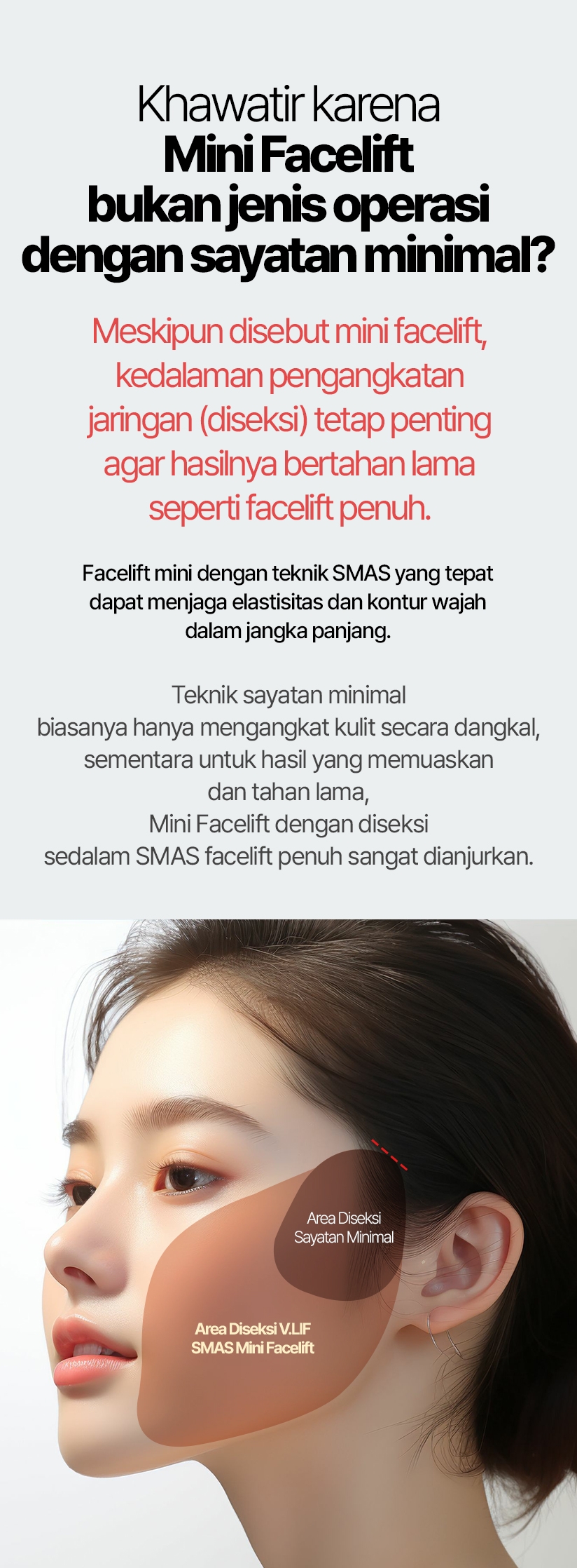 Khawatir karena Mini Facelift bukan jenis operasi dengan sayatan minimal? Meskipun disebut mini facelift, kedalaman pengangkatan jaringan (diseksi) tetap penting agar hasilnya bertahan lama seperti facelift penuh. Facelift mini dengan teknik SMAS yang tepat dapat menjaga elastisitas dan kontur wajah dalam jangka panjang. Teknik sayatan minimal biasanya hanya mengangkat kulit secara dangkal, sementara untuk hasil yang memuaskan dan tahan lama, Mini Facelift dengan diseksi sedalam SMAS facelift penuh sangat dianjurkan.