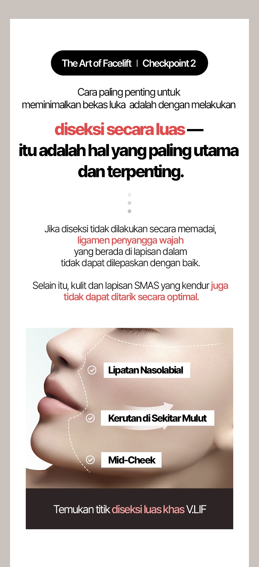 The Art of Facelift / Checkpoint 2 Cara paling penting untuk meminimalkan bekas luka adalah dengan melakukan diseksi secara luas — itu adalah hal yang paling utama dan terpenting. Jika diseksi tidak dilakukan secara memadai, ligamen penyangga wajah yang berada di lapisan dalam tidak dapat dilepaskan  dengan baik. Selain itu, kulit dan lapisan SMAS yang kendur juga tidak dapat ditarik secara optimal. Temukan titik diseksi luas khas V.LIF Lipatan Nasolabial Kerutan di Sekitar Mulut Mid-Cheek