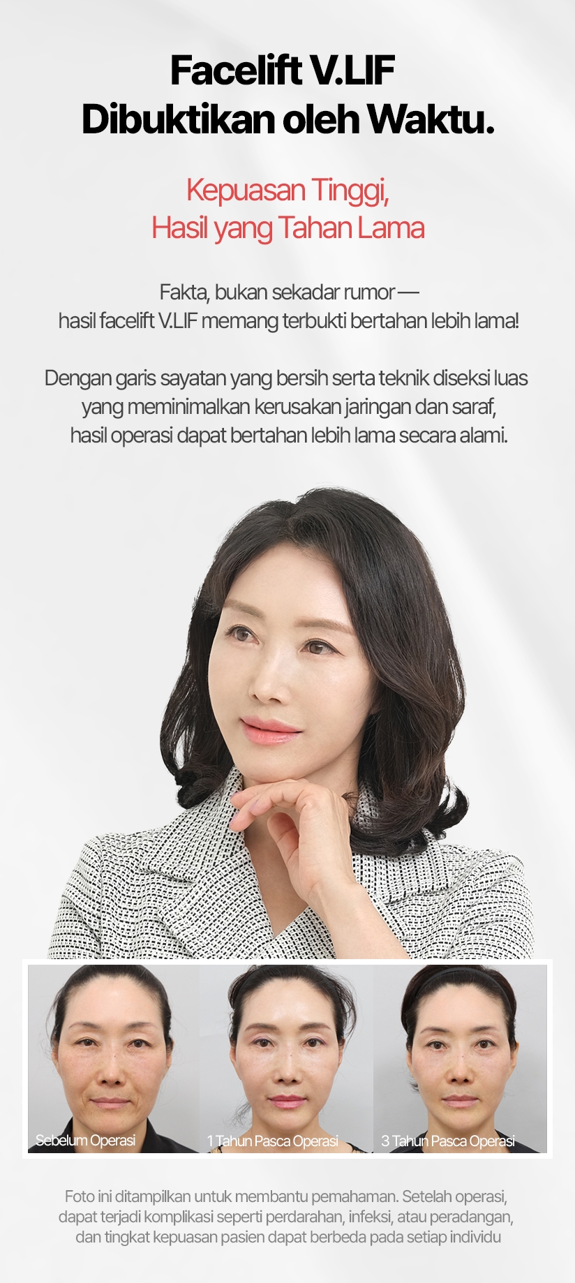 Facelift V.LIF Dibuktikan oleh Waktu. Kepuasan Tinggi, Hasil yang Tahan Lama Fakta, bukan sekadar rumor — hasil facelift V.LIF memang terbukti bertahan lebih lama! Dengan garis sayatan yang bersih serta teknik diseksi luas yang meminimalkan kerusakan jaringan dan saraf, hasil operasi dapat bertahan lebih lama secara alami. Sebelum Operasi | 1 Tahun Pasca Operasi | 3 Tahun Pasca Operasi Foto ini ditampilkan untuk membantu pemahaman. Setelah operasi, dapat terjadi komplikasi seperti perdarahan, infeksi, atau peradangan, dan tingkat kepuasan pasien dapat berbeda pada setiap individu
