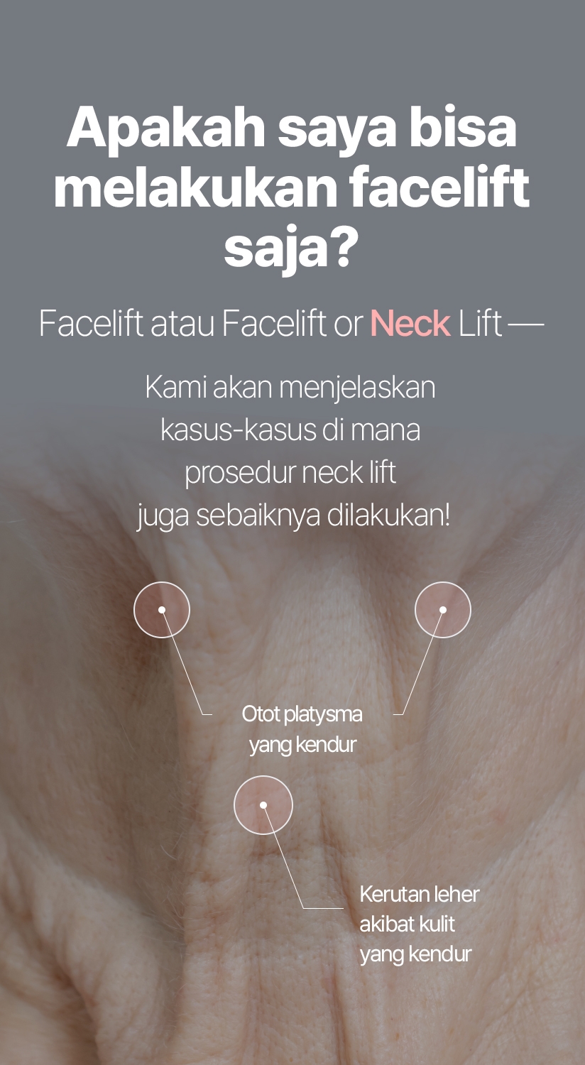 Apakah saya bisa melakukan facelift saja? Facelift atau Facelift or Neck Lift — Kami akan menjelaskan kasus-kasus di mana prosedur neck lift juga sebaiknya dilakukan! Otot platysma yang kendur Kerutan leher akibat kulit yang kendur