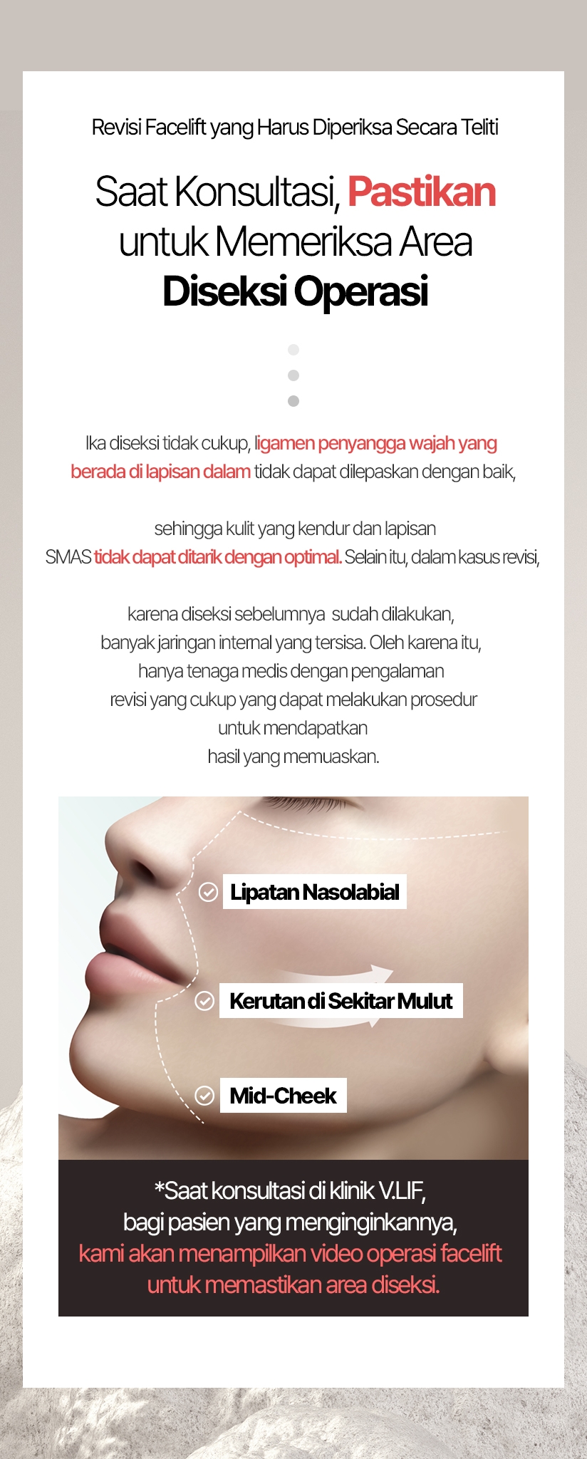 Revisi Facelift yang Harus Diperiksa Secara Teliti Saat Konsultasi, Pastikan untuk Memeriksa Area Diseksi Operasi ika diseksi tidak cukup, ligamen penyangga wajah yang berada di lapisan dalam tidak dapat dilepaskan dengan baik, sehingga kulit yang kendur dan lapisan SMAS tidak dapat ditarik dengan optimal. Selain itu, dalam kasus revisi, karena diseksi sebelumnya sudah dilakukan, banyak jaringan internal yang tersisa. Oleh karena itu, hanya tenaga medis dengan pengalaman revisi yang cukup yang dapat melakukan prosedur untuk mendapatkan hasil yang memuaskan. Lipatan Nasolabial Kerutan di Sekitar Mulut Mid-Cheek *Saat konsultasi di klinik V.LIF, bagi pasien yang menginginkannya, kami akan menampilkan video operasi facelift untuk memastikan area diseksi.