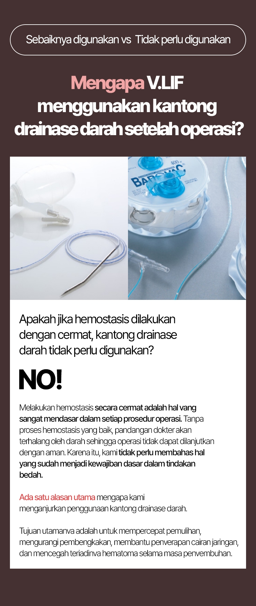 Sebaiknya digunakan vs  Tidak perlu digunakan Mengapa VLIF menggunakan kantong drainase darah setelah operasi? Melakukan hemostasis secara cermat adalah hal yang sangat mendasar dalam setiap prosedur operasi. Tanpa proses hemostasis yang baik, pandangan dokter akan terhalang oleh darah sehingga operasi tidak dapat dilanjutkan dengan aman. Karena itu, kami tidak perlu membahas hal yang sudah menjadi kewajiban dasar dalam tindakan bedah. Ada satu alasan utama mengapa kami menganjurkan penggunaan kantong drainase darah. Tujuan utamanya adalah untuk mempercepat pemulihan, mengurangi pembengkakan, membantu penyerapan cairan jaringan, dan mencegah terjadinya hematoma selama masa penyembuhan.