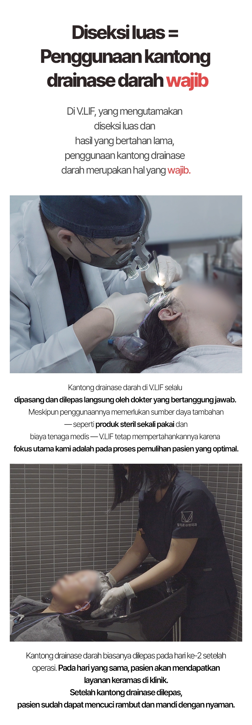 Diseksi luas = Penggunaan kantong drainase darah wajib. Di V.LIF, yang mengutamakan diseksi luas dan hasil yang bertahan lama, penggunaan kantong drainase darah merupakan hal yang wajib. Kantong drainase darah di V.LIF selalu dipasang dan dilepas langsung oleh dokter yang bertanggung jawab. Meskipun penggunaannya memerlukan sumber daya tambahan — seperti produk steril sekali pakai dan biaya tenaga medis — V.LIF tetap mempertahankannya karena fokus utama kami adalah pada proses pemulihan pasien yang optimal. Kantong drainase darah biasanya dilepas pada hari ke-2 setelah operasi. Pada hari yang sama, pasien akan mendapatkan layanan keramas di klinik. Setelah kantong drainase dilepas, pasien sudah dapat mencuci rambut dan mandi dengan nyaman.