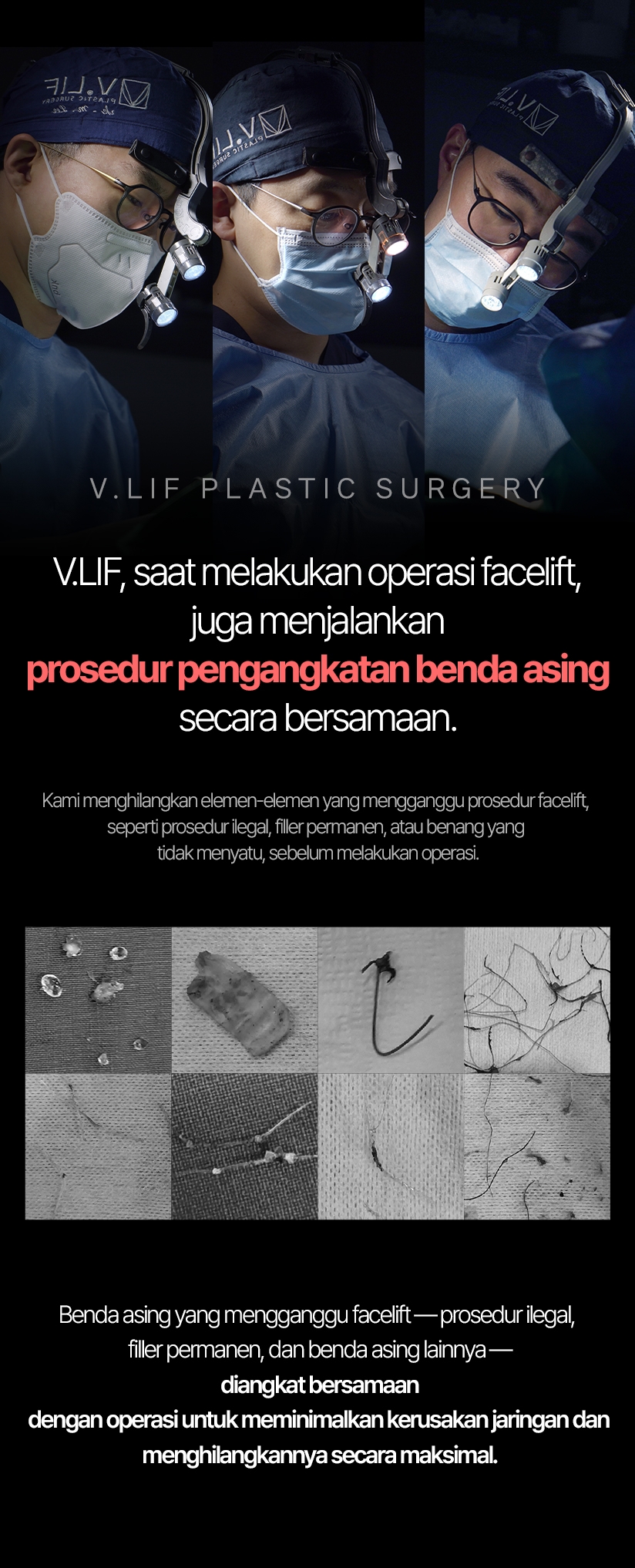 V.LIF, saat melakukan operasi facelift, juga menjalankan prosedur pengangkatan benda asing secara bersamaan. Kami menghilangkan elemen-elemen yang mengganggu prosedur facelift, seperti prosedur ilegal, filler permanen, atau benang yang tidak menyatu, sebelum melakukan operasi. Benda asing yang mengganggu facelift — prosedur ilegal, filler permanen, dan benda asing lainnya — diangkat bersamaan dengan operasi untuk meminimalkan kerusakan jaringan dan menghilangkannya secara maksimal.