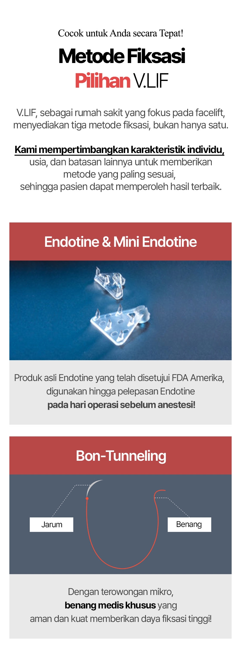 Cocok untuk Anda secara Tepat! Metode Fiksasi Pilihan V.LIF V.LIF, sebagai rumah sakit yang fokus pada facelift, menyediakan tiga metode fiksasi, bukan hanya satu. Kami mempertimbangkan karakteristik individu, usia, dan batasan lainnya untuk memberikan metode yang paling sesuai, sehingga pasien dapat memperoleh hasil terbaik. Endotine & Mini Endotine Produk asli Endotine yang telah disetujui FDA Amerika, digunakan hingga pelepasan Endotine pada hari operasi sebelum anestesi! Bon-Tunneling Dengan terowongan mikro, benang medis khusus yang aman dan kuat memberikan daya fiksasi tinggi!