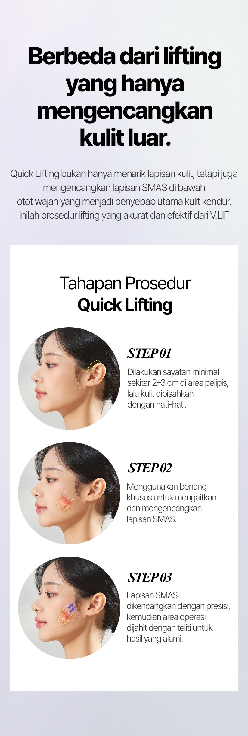 Berbeda dari lifting yang hanya mengencangkan kulit luar. Quick Lifting bukan hanya menarik lapisan kulit, tetapi juga mengencangkan lapisan SMAS di bawah otot wajah yang menjadi penyebab utama kulit kendur. Inilah prosedur lifting yang akurat dan efektif dari V.LIF. Tahapan Prosedur Quick Lifting STEP 01 Dilakukan sayatan minimal sekitar 2–3 cm di area pelipis, lalu kulit dipisahkan dengan hati-hati. STEP 02 Menggunakan benang khusus untuk mengaitkan dan mengencangkan lapisan SMAS. STEP 03 Lapisan SMAS dikencangkan dengan presisi, kemudian area operasi dijahit dengan teliti untuk hasil yang alami.