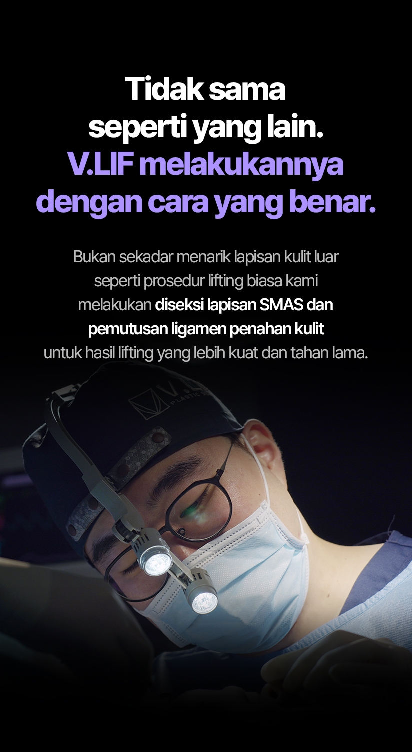 Tidak sama seperti yang lain. V.LIF melakukannya dengan cara yang benar. Bukan sekadar menarik lapisan kulit luar seperti prosedur lifting biasa kami melakukan diseksi lapisan SMAS dan pemutusan ligamen penahan kulit untuk hasil lifting yang lebih kuat dan tahan lama.