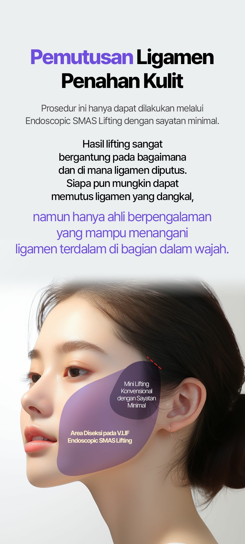 Pemutusan Ligamen Penahan Kulit Prosedur ini hanya dapat dilakukan melalui Endoscopic SMAS Lifting dengan sayatan minimal. Hasil lifting sangat bergantung pada bagaimana dan di mana ligamen diputus. Siapa pun mungkin dapat memutus ligamen yang dangkal, namun hanya ahli berpengalaman yang mampu menangani ligamen terdalam di bagian dalam wajah. Mini Lifting Konvensional dengan Sayatan Minimal Area Diseksi pada V.LIF Endoscopic SMAS Lifting