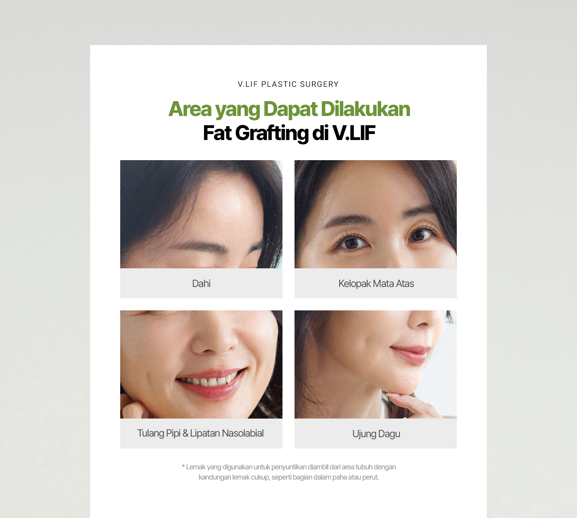 V.LIF PLASTIC SURGERY Area yang Dapat Dilakukan Fat Grafting di V.LIF Dahi Kelopak Mata Atas Tulang Pipi & Lipatan Nasolabial Ujung Dagu * Lemak yang digunakan untuk penyuntikan diambil dari area tubuh dengan kandungan lemak cukup, seperti bagian dalam paha atau perut.
