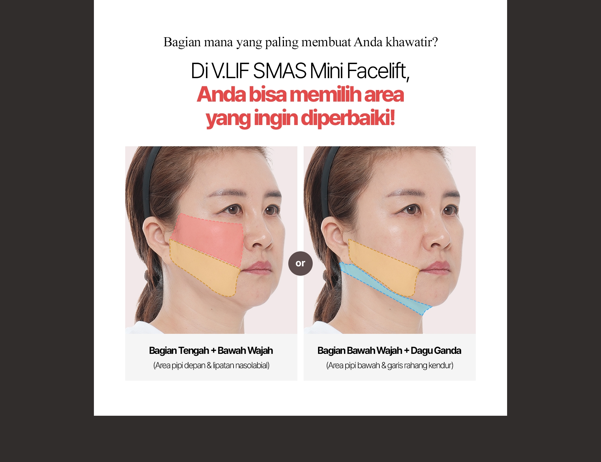 Bagian mana yang paling membuat Anda khawatir? Di V.LIF SMAS Mini Facelift, Anda bisa memilih area yang ingin diperbaiki! Bagian Bawah Wajah + Dagu Ganda (Area pipi bawah & garis rahang kendur)