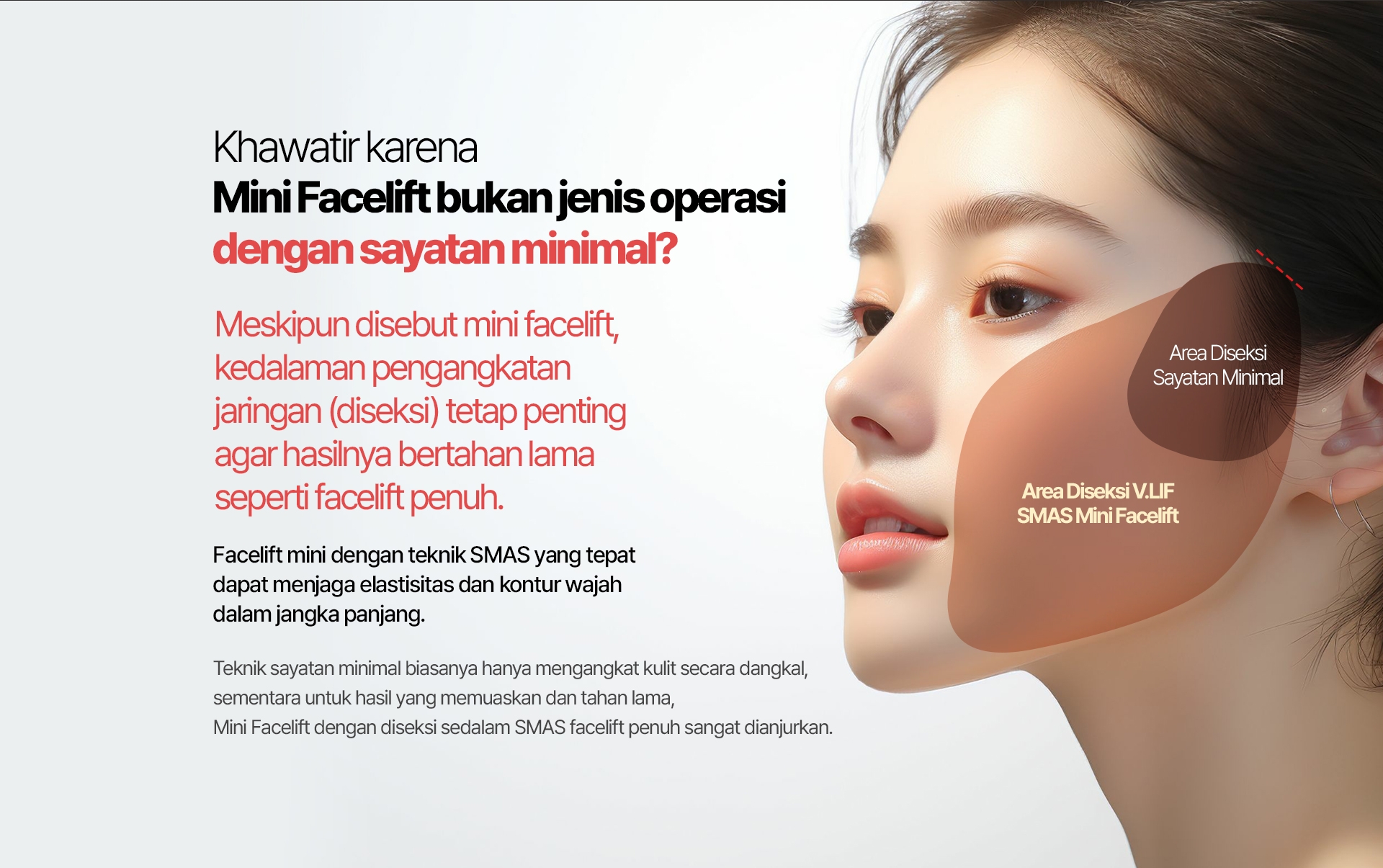 Khawatir karena Mini Facelift bukan jenis operasi dengan sayatan minimal? Meskipun disebut mini facelift, kedalaman pengangkatan jaringan (diseksi) tetap penting agar hasilnya bertahan lama seperti facelift penuh. Facelift mini dengan teknik SMAS yang tepat dapat menjaga elastisitas dan kontur wajah dalam jangka panjang. Teknik sayatan minimal biasanya hanya mengangkat kulit secara dangkal, sementara untuk hasil yang memuaskan dan tahan lama, Mini Facelift dengan diseksi sedalam SMAS facelift penuh sangat dianjurkan.