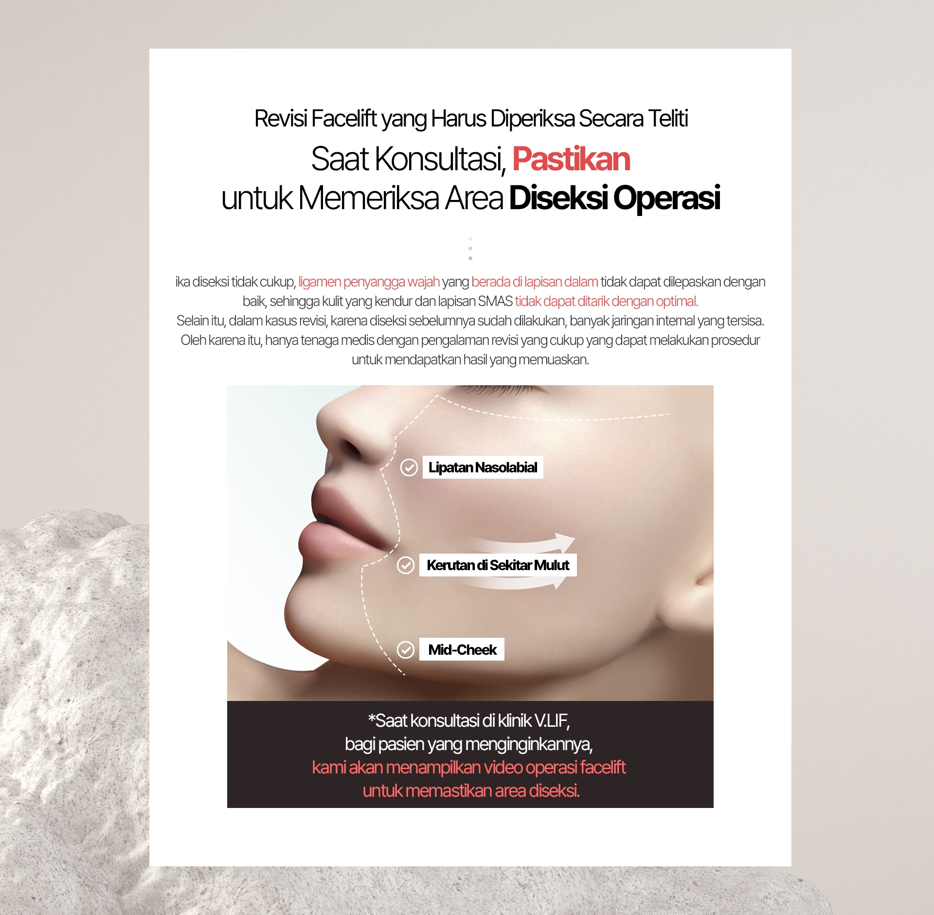 Revisi Facelift yang Harus Diperiksa Secara Teliti Saat Konsultasi, Pastikan untuk Memeriksa Area Diseksi Operasi ika diseksi tidak cukup, ligamen penyangga wajah yang berada di lapisan dalam tidak dapat dilepaskan dengan baik, sehingga kulit yang kendur dan lapisan SMAS tidak dapat ditarik dengan optimal. Selain itu, dalam kasus revisi, karena diseksi sebelumnya sudah dilakukan, banyak jaringan internal yang tersisa. Oleh karena itu, hanya tenaga medis dengan pengalaman revisi yang cukup yang dapat melakukan prosedur untuk mendapatkan hasil yang memuaskan. Lipatan Nasolabial Kerutan di Sekitar Mulut Mid-Cheek *Saat konsultasi di klinik V.LIF, bagi pasien yang menginginkannya, kami akan menampilkan video operasi facelift untuk memastikan area diseksi.