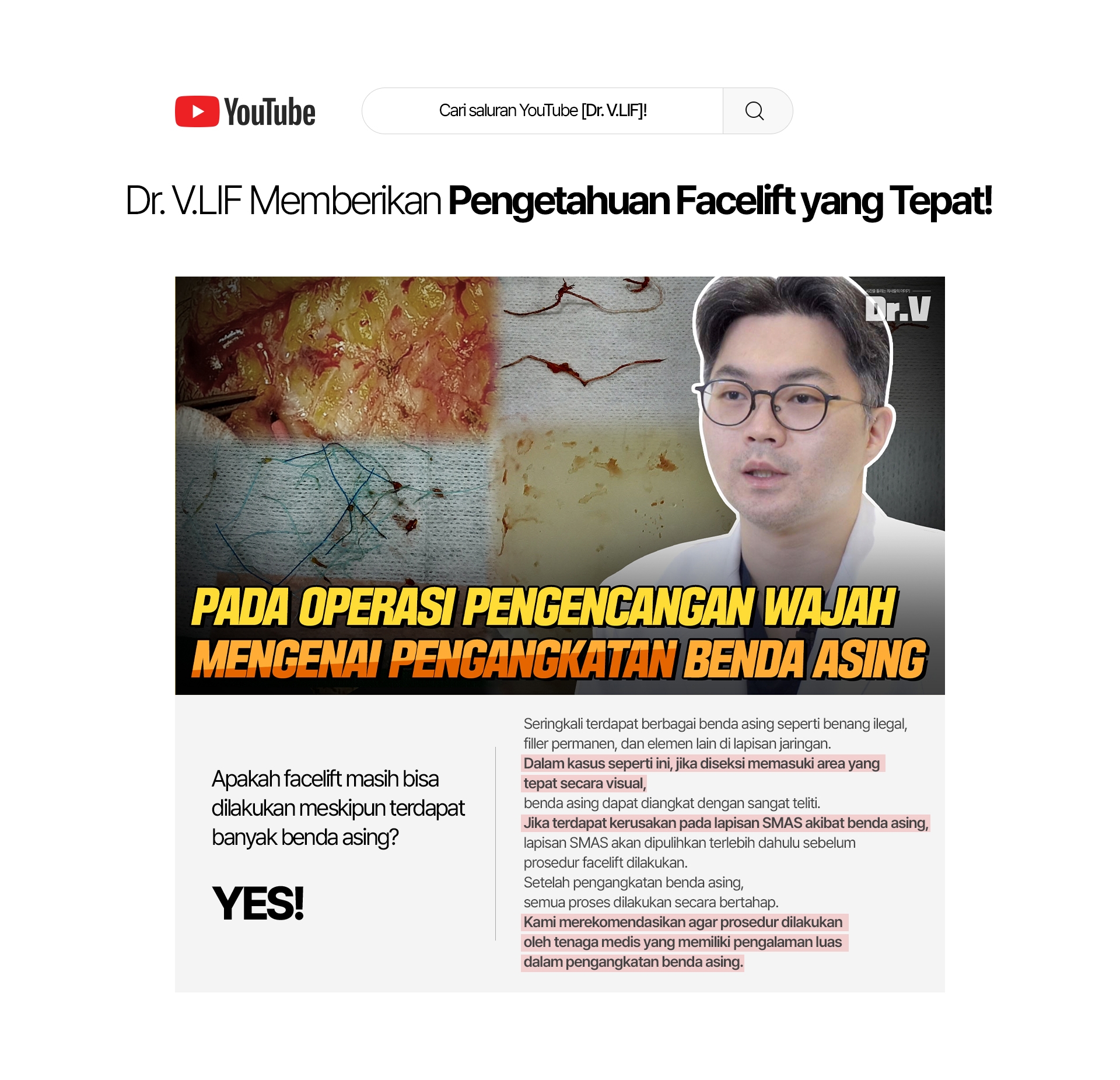 Cari saluran YouTube [Dr. V.LIF]! Dr. V.LIF Memberikan Pengetahuan Facelift yang Tepat! Seringkali terdapat berbagai benda asing seperti benang ilegal, filler permanen, dan elemen lain di lapisan jaringan. Dalam kasus seperti ini, jika diseksi memasuki area yang tepat secara visual, benda asing dapat diangkat dengan sangat teliti. Jika terdapat kerusakan pada lapisan SMAS akibat benda asing, lapisan SMAS akan dipulihkan terlebih dahulu sebelum prosedur facelift dilakukan. Setelah pengangkatan benda asing, semua proses dilakukan secara bertahap. Kami merekomendasikan agar prosedur dilakukan oleh tenaga medis yang memiliki pengalaman luas dalam pengangkatan benda asing. Apakah facelift masih bisa dilakukan meskipun terdapat banyak benda asing? YES!