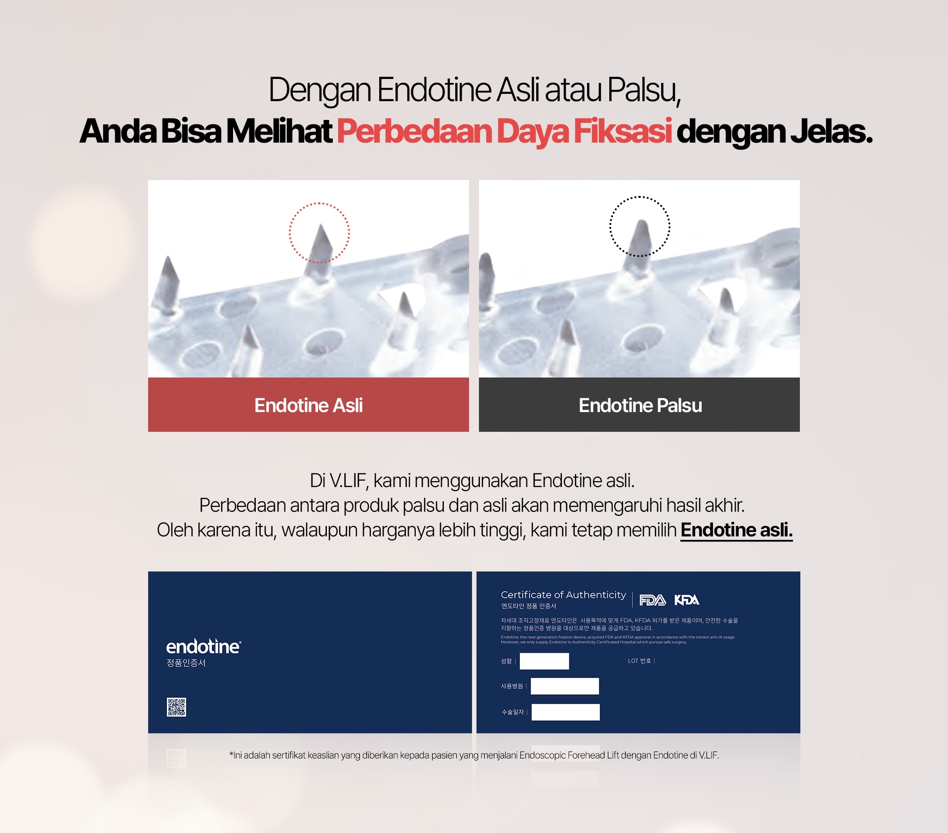 Dengan Endotine Asli atau Palsu, Anda Bisa Melihat Perbedaan Daya Fiksasi dengan Jelas. Endotine Asli Endotine Palsu Di V.LIF, kami menggunakan Endotine asli. Perbedaan antara produk palsu dan asli akan memengaruhi hasil akhir. Oleh karena itu, walaupun harganya lebih tinggi, kami tetap memilih Endotine asli. Ini adalah sertifikat keaslian yang diberikan kepada pasien yang menjalani Endoscopic Forehead Lift dengan Endotine di V.LIF.