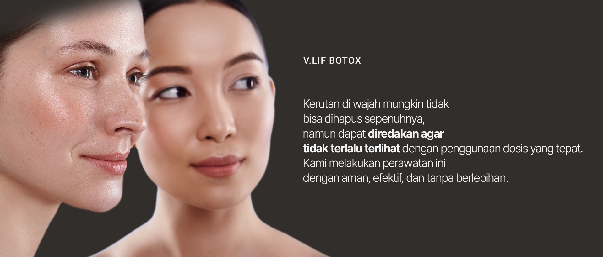 V.LIF BOTOX Kerutan di wajah mungkin tidak bisa dihapus sepenuhnya, namun dapat diredakan agar tidak terlalu terlihat dengan penggunaan dosis yang tepat. Kami melakukan perawatan ini dengan aman, efektif, dan tanpa berlebihan. 