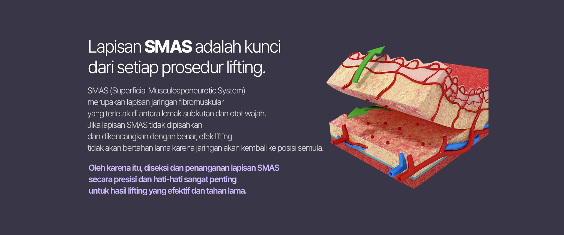 Lapisan SMAS adalah kunci dari setiap prosedur lifting. SMAS (Superficial Musculoaponeurotic System) merupakan lapisan jaringan fibromuskular yang terletak di antara lemak subkutan dan otot wajah. Jika lapisan SMAS tidak dipisahkan dan dikencangkan dengan benar, efek lifting tidak akan bertahan lama karena jaringan akan kembali ke posisi semula. Oleh karena itu, diseksi dan penanganan lapisan SMAS secara presisi dan hati-hati sangat penting untuk hasil lifting yang efektif dan tahan lama.
