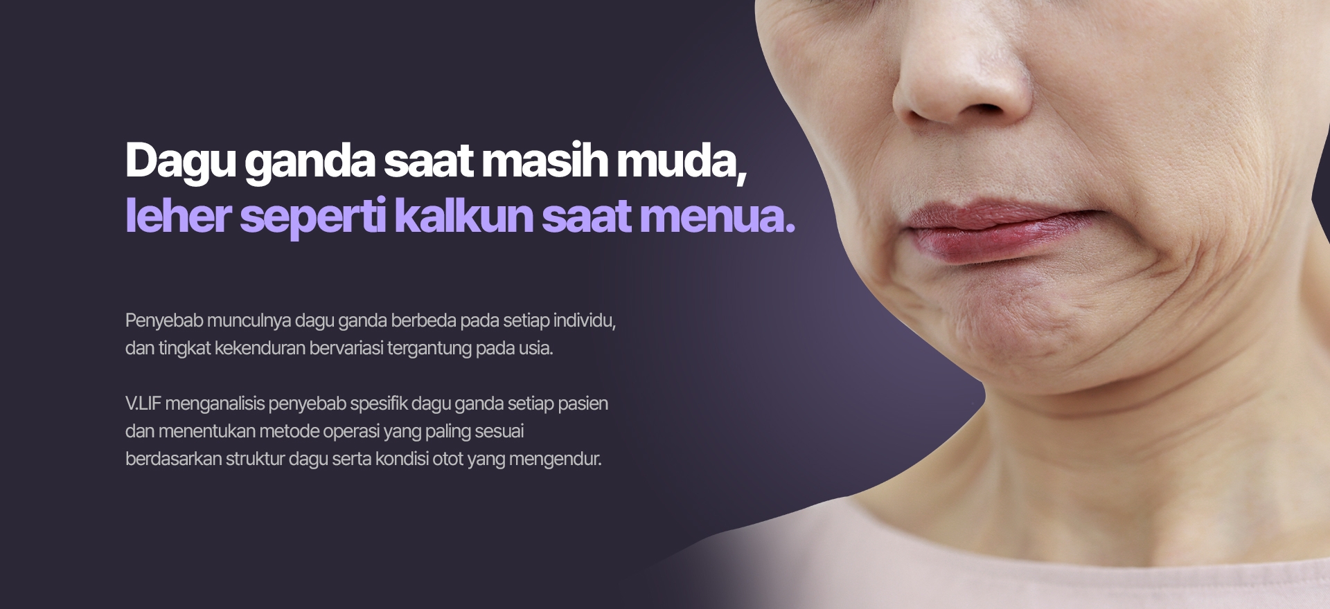 Dagu ganda saat masih muda, leher seperti kalkun saat menua. Penyebab munculnya dagu ganda berbeda pada setiap individu, dan tingkat kekenduran bervariasi tergantung pada usia. V.LIF menganalisis penyebab spesifik dagu ganda setiap pasien dan menentukan metode operasi yang paling sesuai berdasarkan struktur dagu serta kondisi otot yang mengendur.