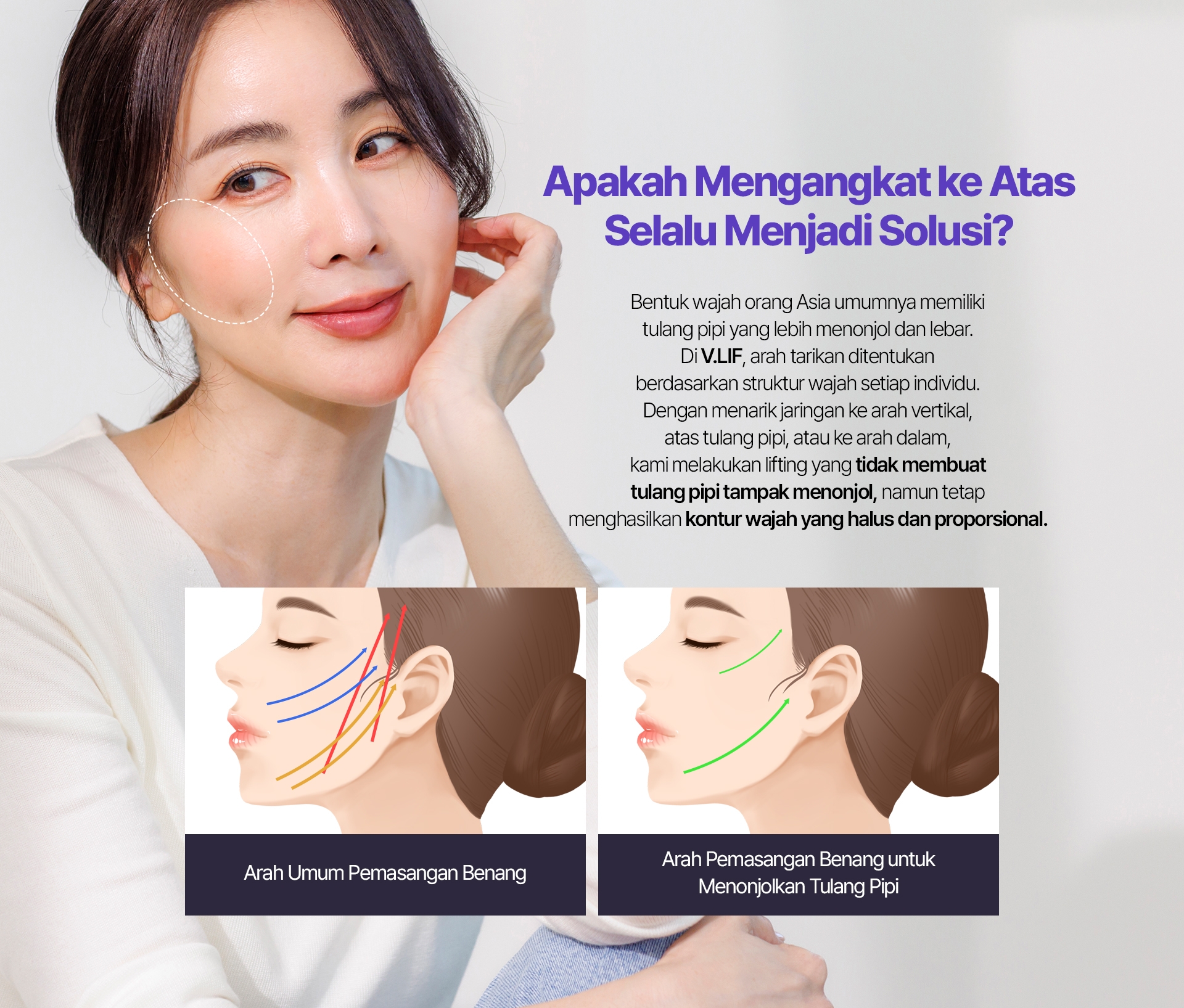 Apakah Mengangkat ke Atas Selalu Menjadi Solusi? Bentuk wajah orang Asia umumnya memiliki tulang pipi yang lebih menonjol dan lebar. Di V.LIF, arah tarikan ditentukan berdasarkan struktur wajah setiap individu. Dengan menarik jaringan ke arah vertikal, atas tulang pipi, atau ke arah dalam, kami melakukan lifting yang tidak membuat tulang pipi tampak menonjol, namun tetap menghasilkan kontur wajah yang halus dan proporsional. Arah Umum Pemasangan Benang Arah Pemasangan Benang untuk Menonjolkan Tulang Pipi